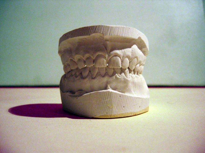 Just the Tooth